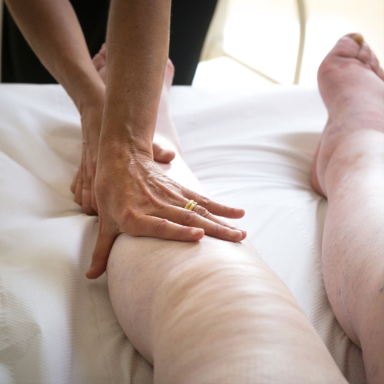 Oedeem fysiotherapie